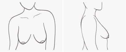 Breast shape Relaxed
